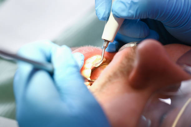 Best Broken or Chipped Tooth Repair in Munsey Park, NY