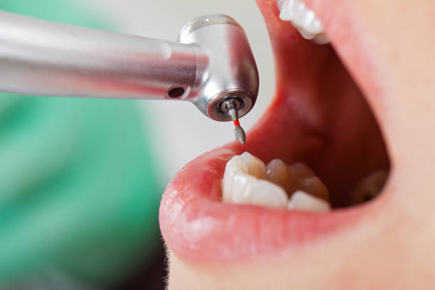 Best Emergency Care for Gum Disease in Munsey Park, NY